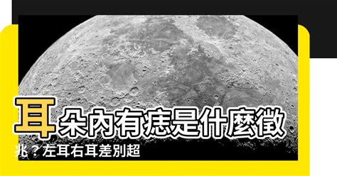 右耳朵突然長痣|【右耳朵突然長痣】右耳朵突然長痣的玄機：吉祥徵兆還是健康警。